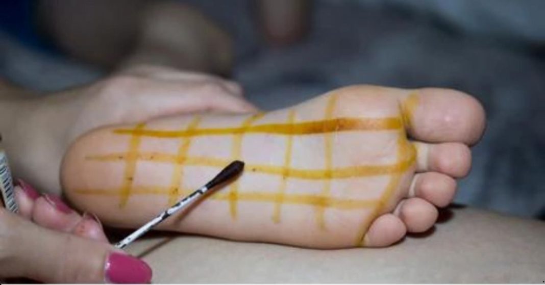 Iodine grid Iodine grid