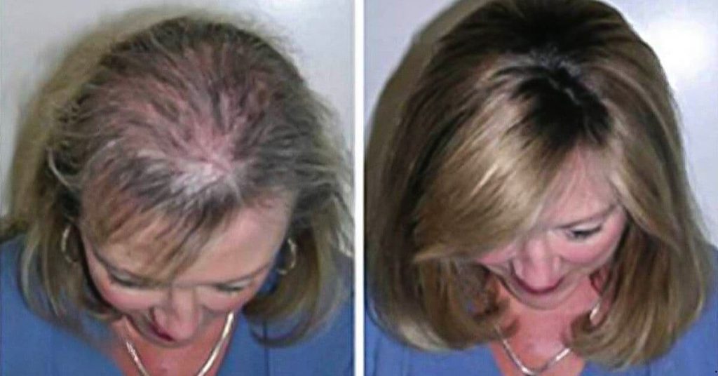 Shampoo for Fast Hair Growth