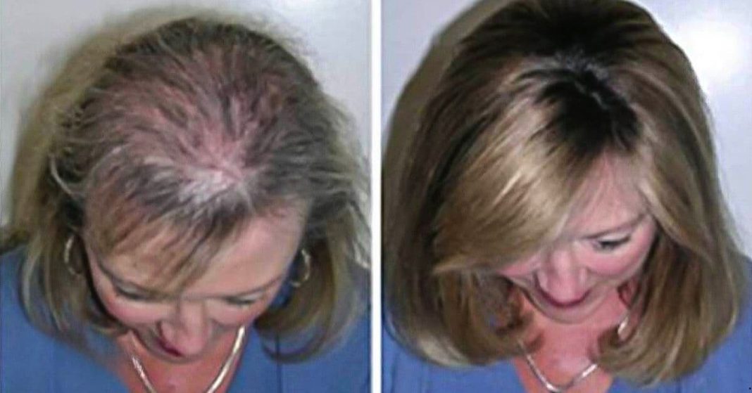 Shampoo for Fast Hair Growth Shampoo for Fast Hair Growth