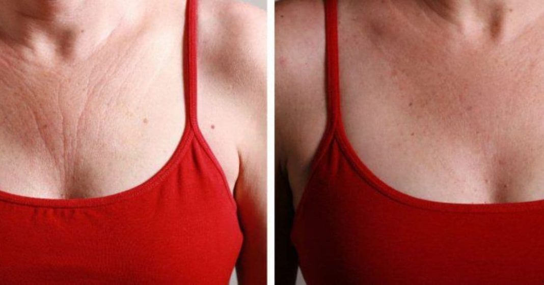 anti-wrinkle ointment