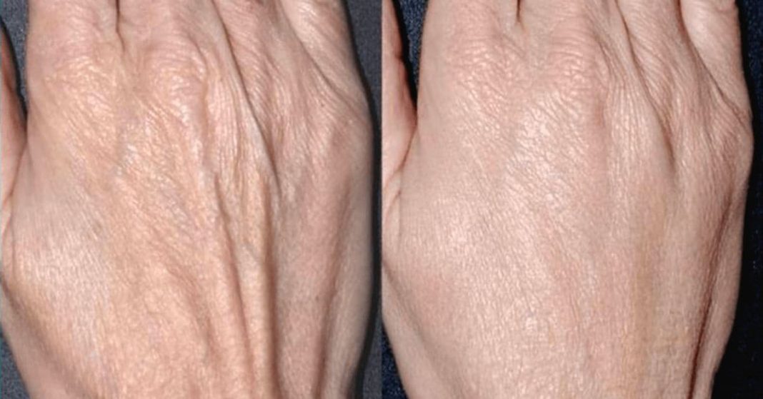 How to Keep Your Hands Young and Healthy How to Keep Your Hands Young and Healthy