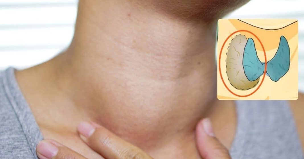 ფარისებრი ჯირკვალი