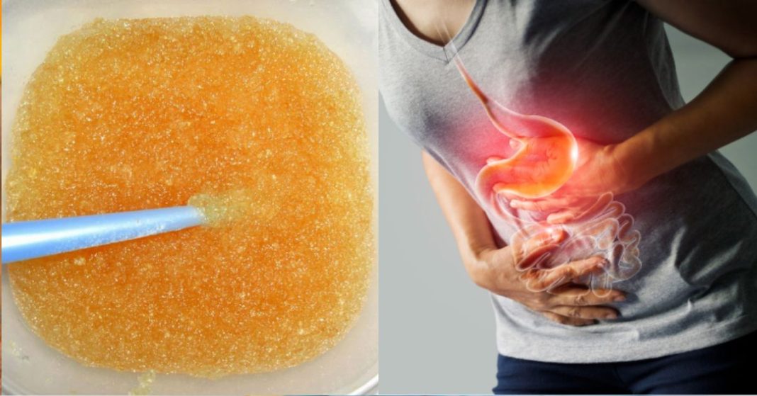 გასტრიტი