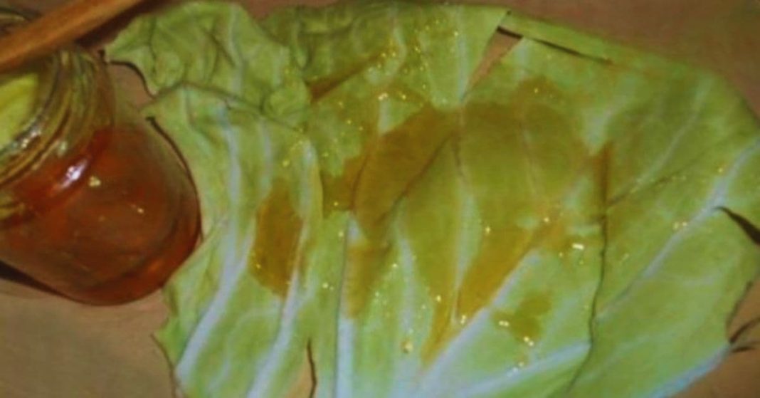 კომბოსტო