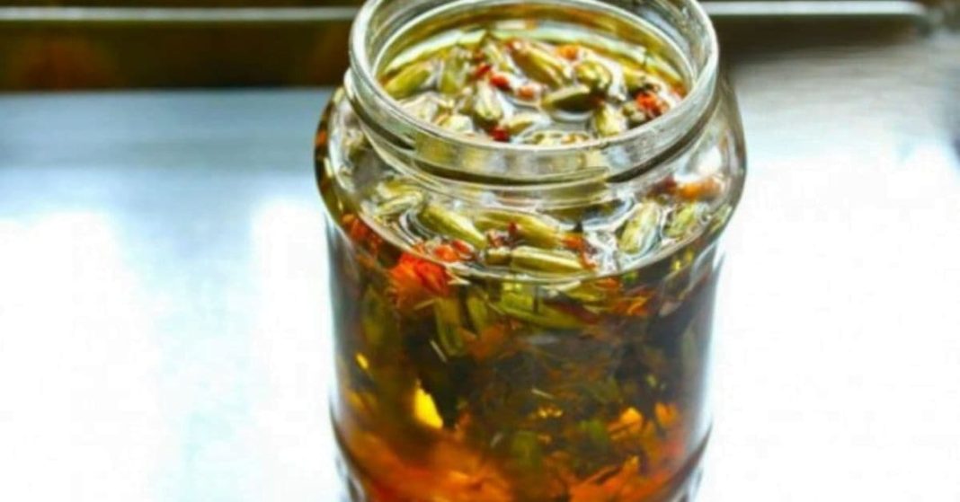 ოსტეოქონდროზი