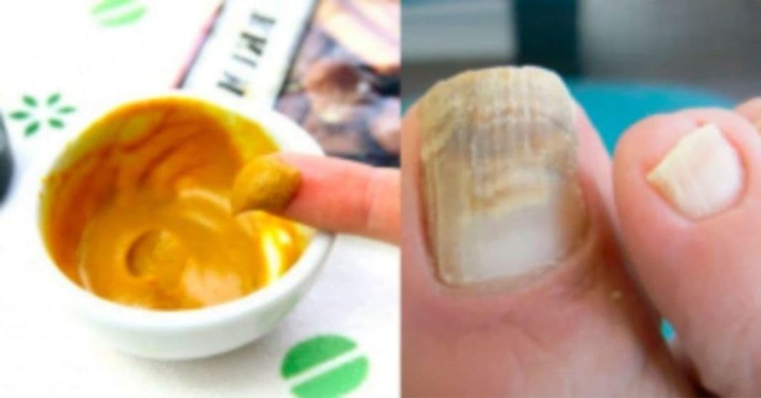 nato xalxuri (16) (2)