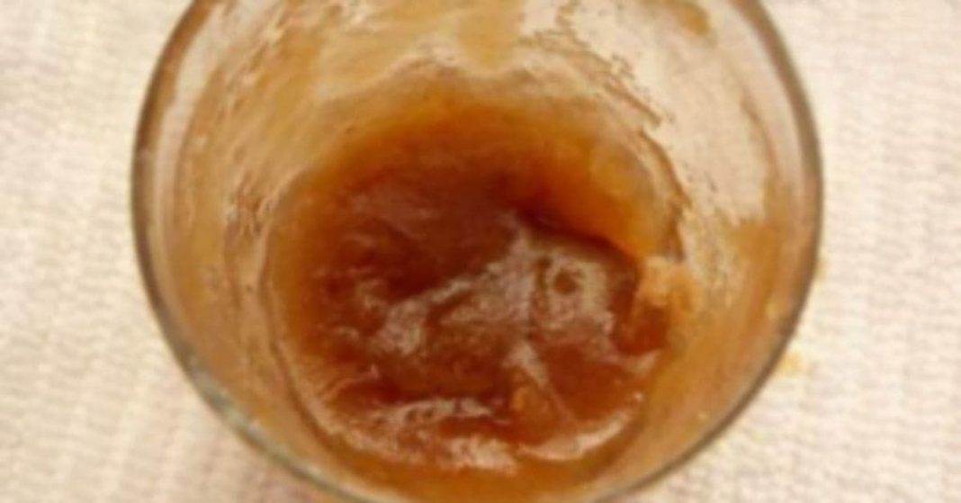 უძილობის მკურნალობა