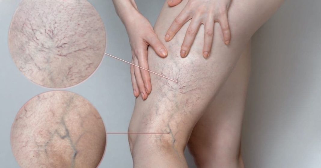 ნატო xalxuri (77) (1)