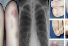 10 symptoms that, if ignored, can lead to cancer in the future. Important information